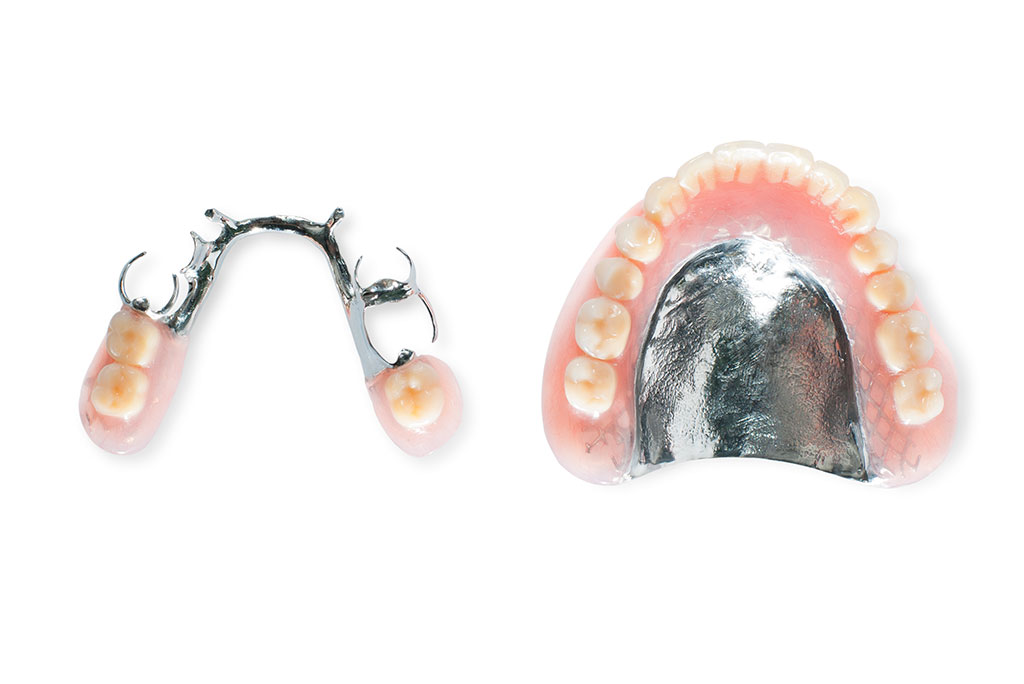 メンテナンスの違い